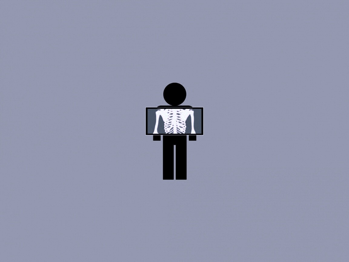 Рентген обои