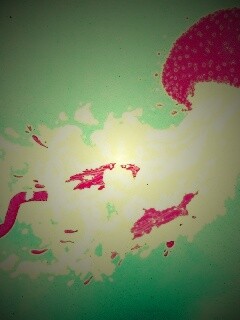 Розовая медуза обои